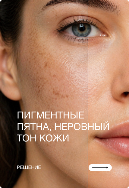 Пигментные пятна, неровный тон кожи