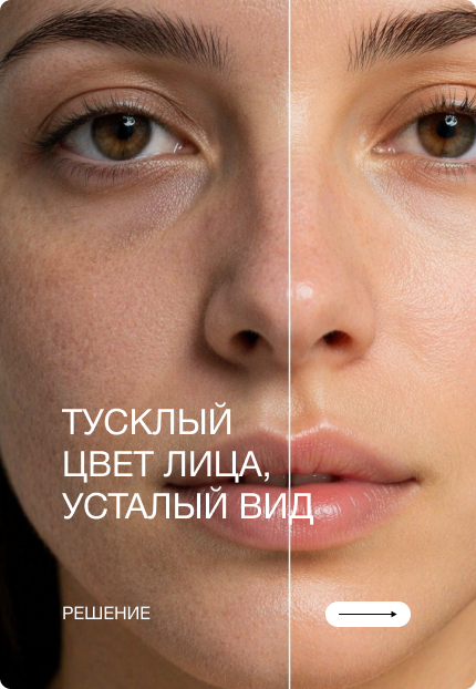 Тусклый цвет лица, усталый вид