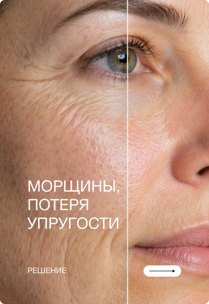 Морщины, потеря упругости